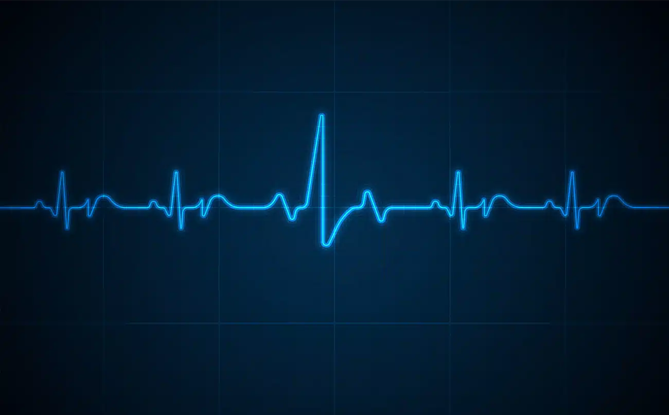 Heart Rhythm