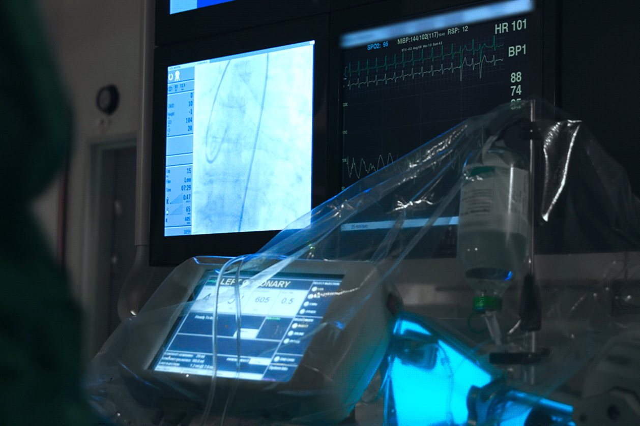 Carotid Endarterectomy