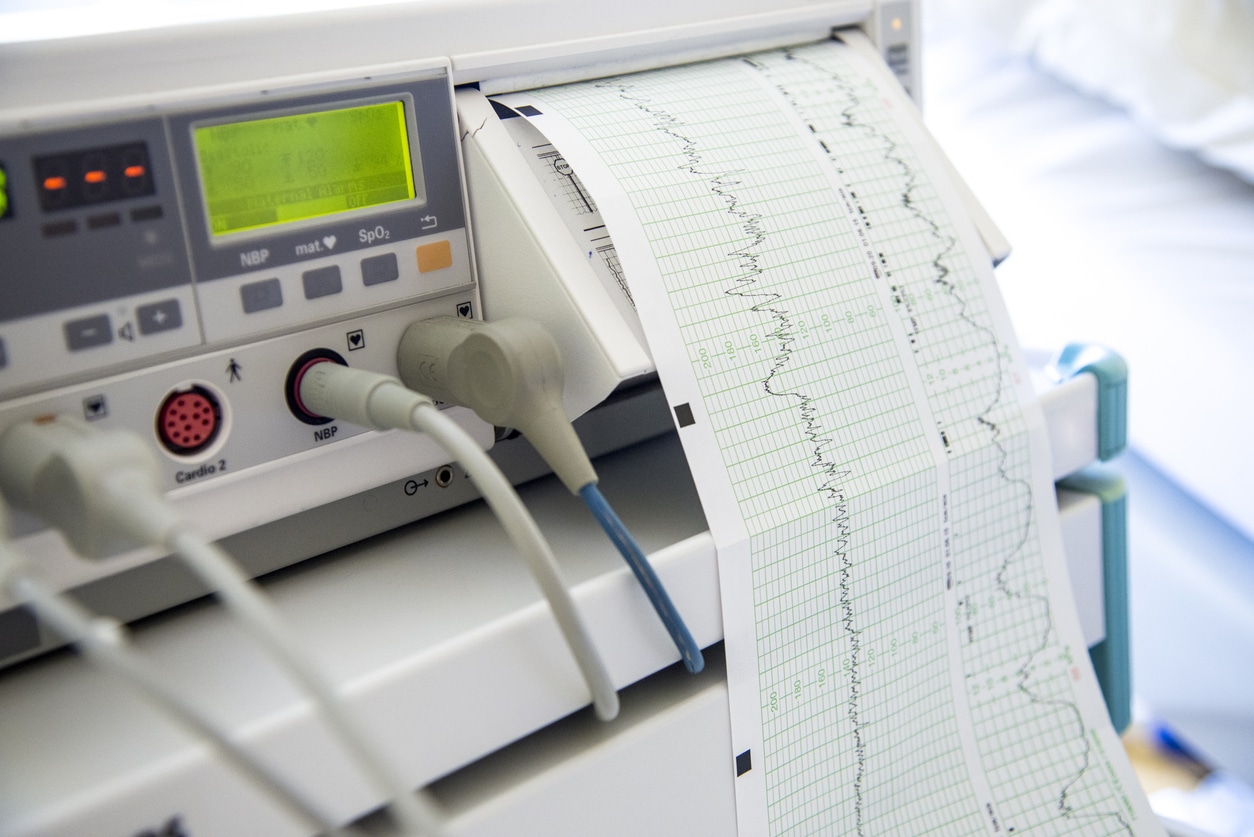 TAVR