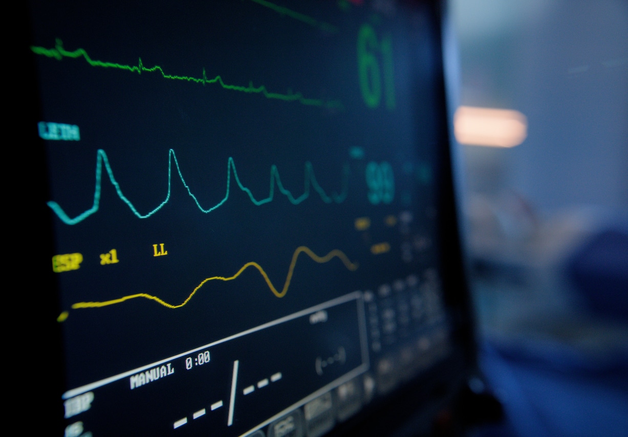 Vital signs monitor