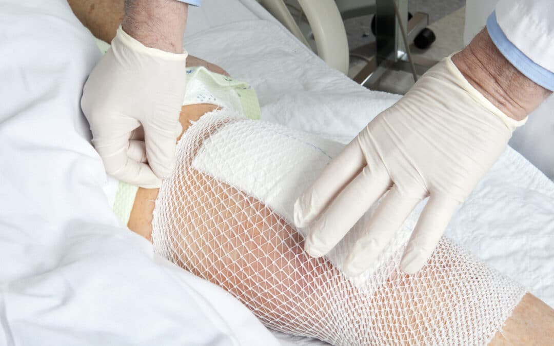 The Vital Link Between Circulation and Wound Healing: Navigating Through the Challenges of Peripheral Arterial Disease