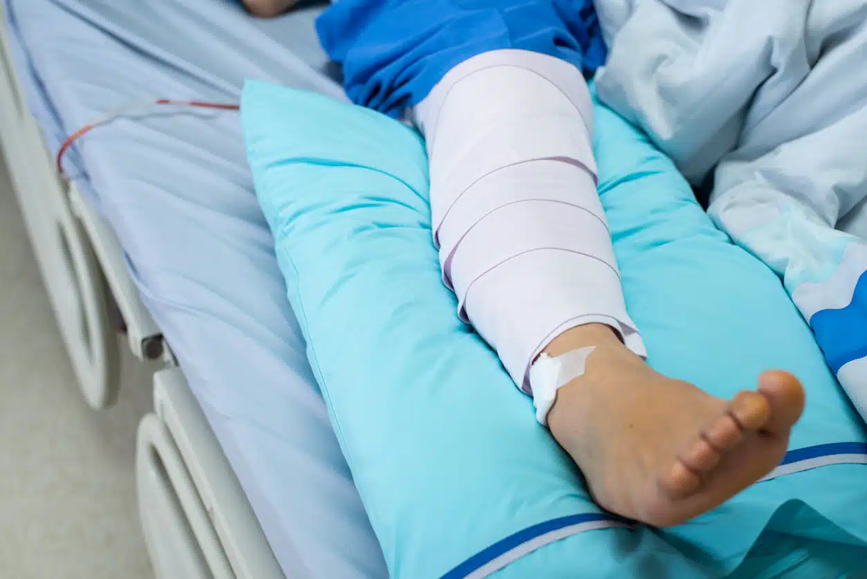 Patient With Critical Limb Ischemia