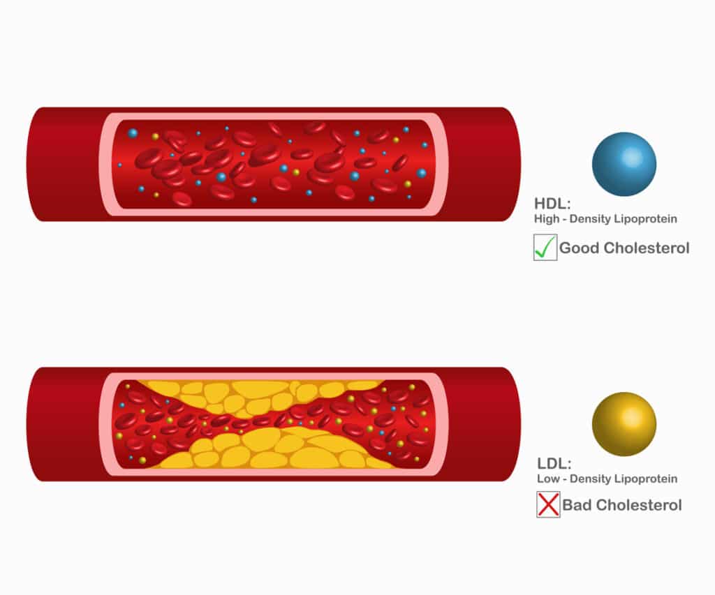 HDL and LDL Cholesterol