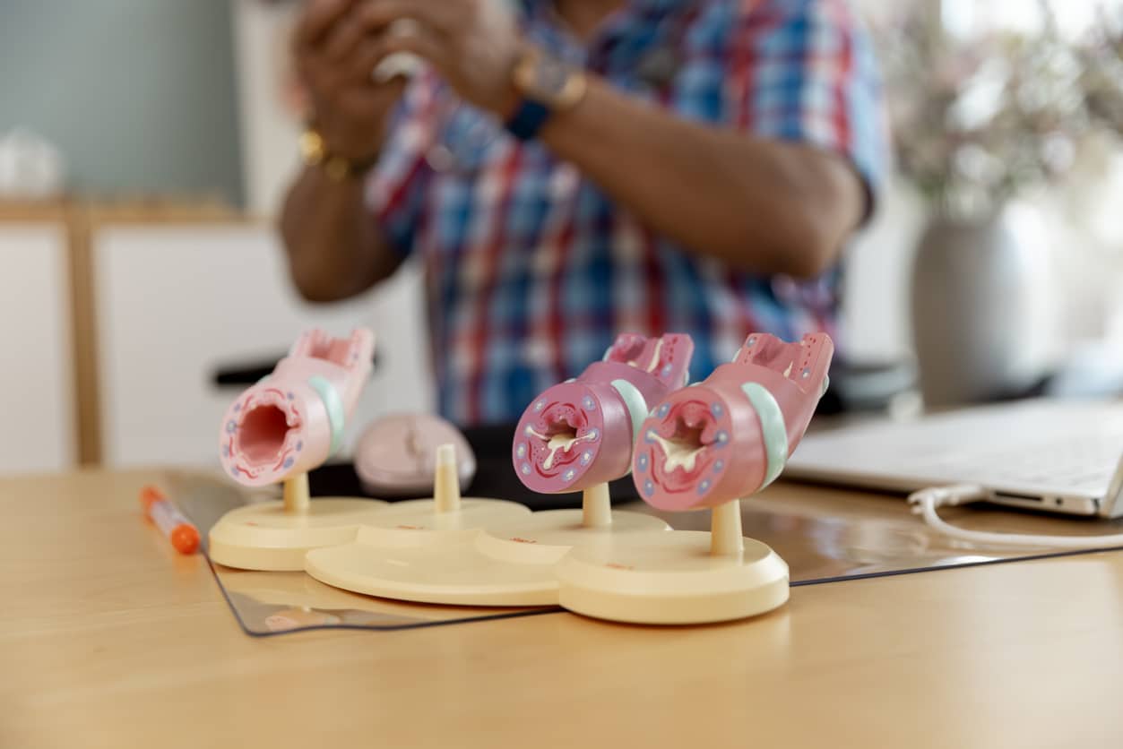 Diagram of clogged arteries